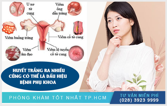 Huyết trắng ra nhiều có thể là dấu hiệu của bệnh lý